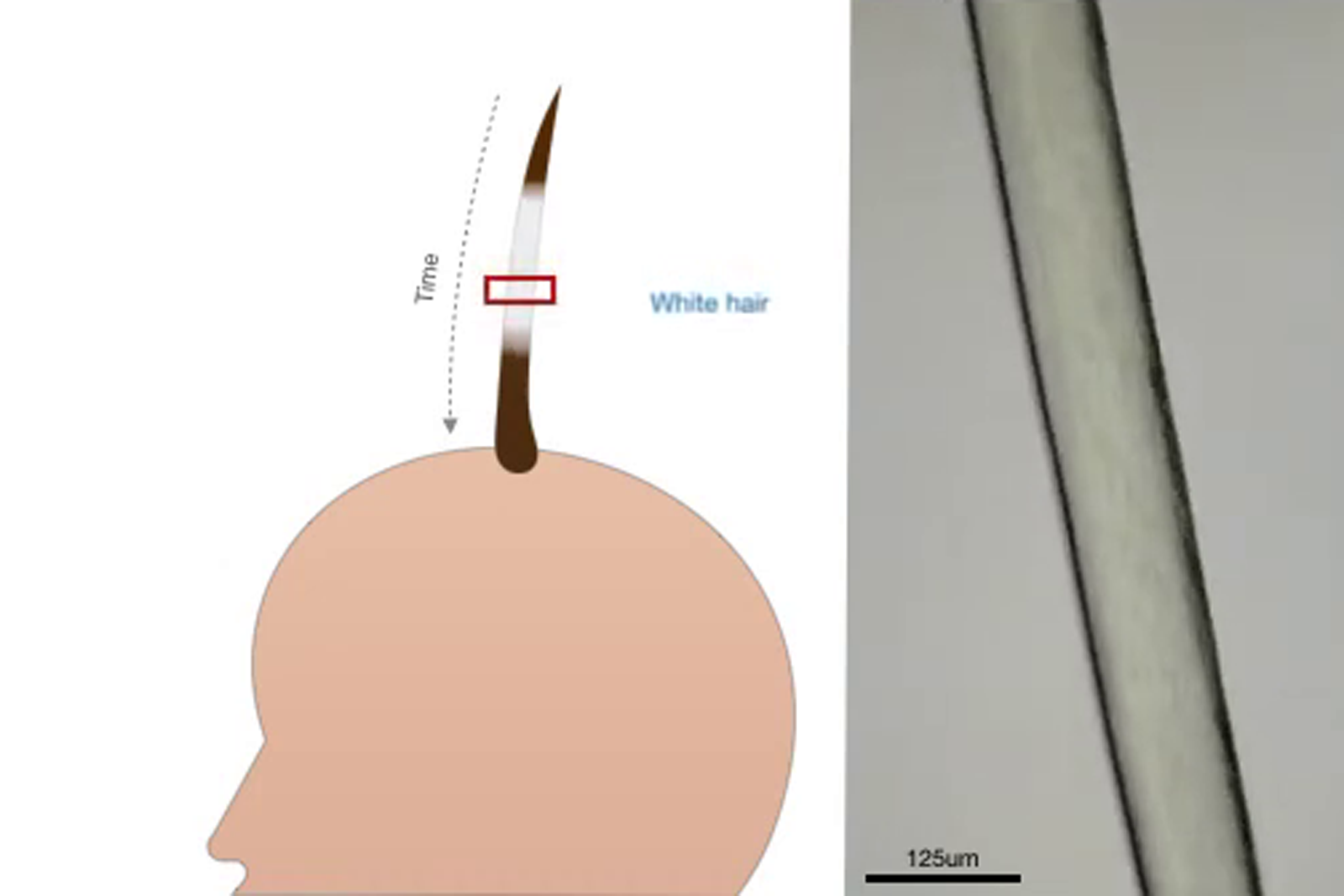 ストレスと白髪には顕著な相関、心理的負荷取り除けば元の色に戻る可能性をコロンビア大学の研究者が確認